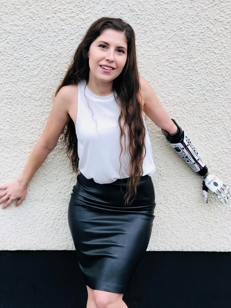 Illustration for article titled 'Bionic Actress' Angel Giuffria Is Ready for People With Disabilities to Get Their Close-Up
